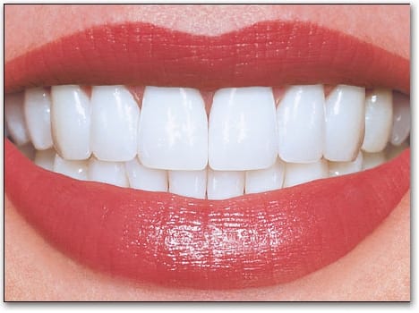 The teeth will be polished in the countryside
